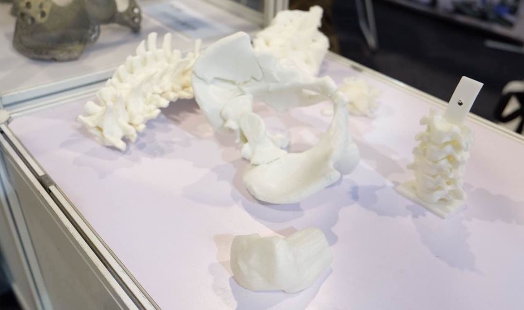 3d printing in medcial 3d printing in medcial