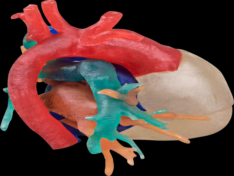 Surgical auxiliary model making Surgical auxiliary model making